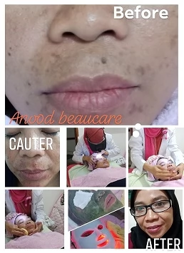 Perawatan Wajah Profesional